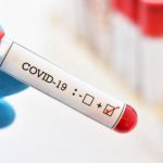 آیا سیستم ایمنی می تواند COVID-۱۹ را درمان کند؟